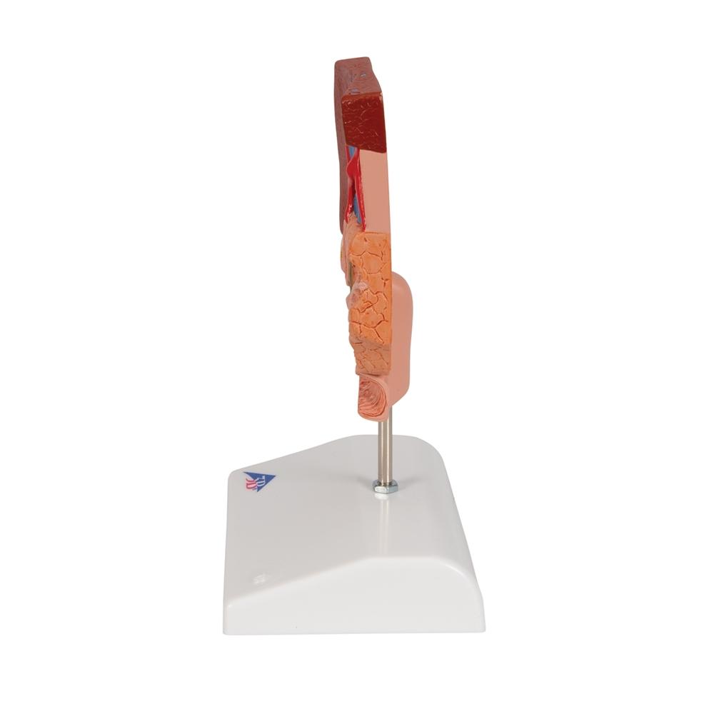 Gallstone Model with 3B Smart Anatomy K26 - Medical Teaching Tool for Human Digestive System Study & Classroom Demonstration