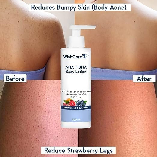Glycolic & Lactic Acid Body Lotion for Smooth Skin - Niacinamide Moisturizer for Rough & Bumpy Skin - 200ml Hydrating Body Cream - Perfect for Daily Use & Post-Shower Care