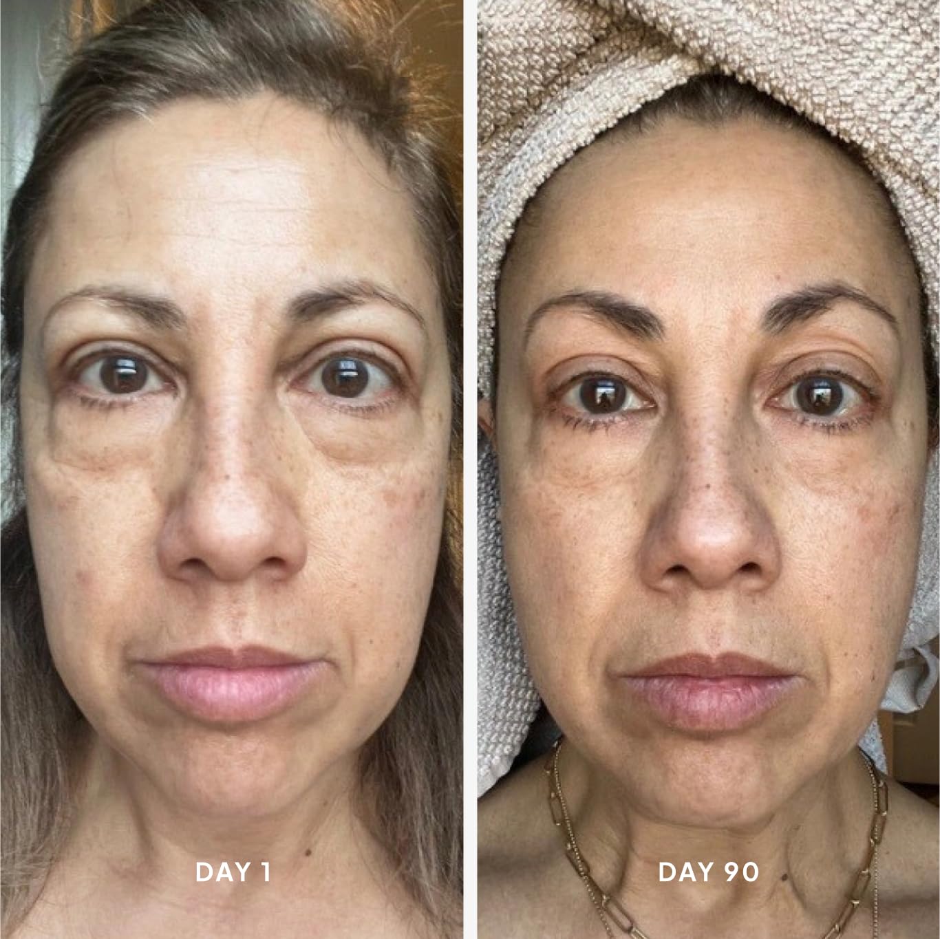 Droplette Collagen-Boosting Hydrofiller Refill Capsules - Anti-Aging Skincare Treatment with Collagen, Argireline, Vitamin C & Turmeric for Hydration, Plumping & Lifting - 30 Capsules for Face & Neck Rejuvenation - Perfect for Daily Skincare Routine & Travel