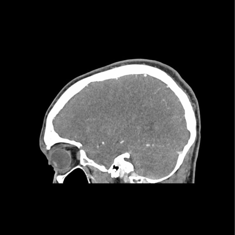 CTA AVM Head Phantom for CT Scan & X-Ray Training - Medical Imaging Practice, Radiology Education & Diagnostic Testing Simulation
