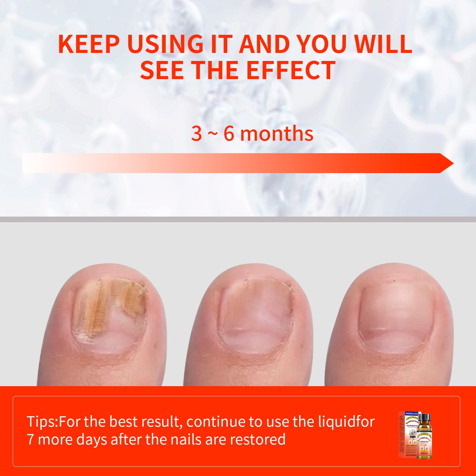 Extra Strength Toenail Fungus Treatment Liquid with Soft Brush Head - Fast & Effective Fungal Nail Solution (30ml) for Healthy Toenails - Perfect for Athletes, Swimmers & Daily Foot Care