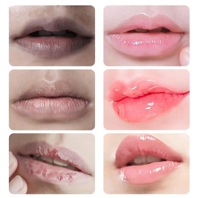 JINSHANE Lip Serum & Balm Set - Korean Dark Lip Treatment, Moisturizing Nourishing Essence for Dry Lips (4PCS) | Perfect for Night Care, Daily Hydration & Lip Makeup Prep