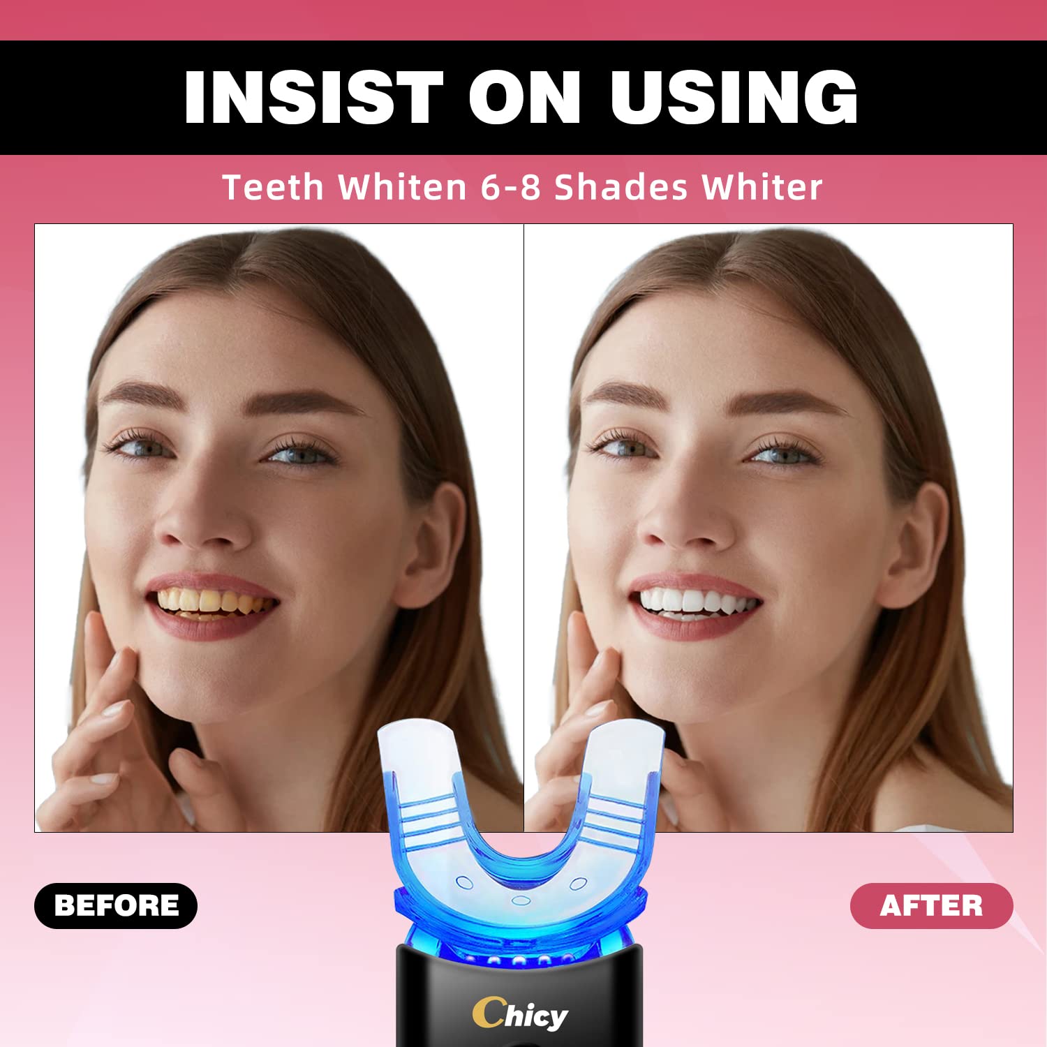 CHICY Teeth Whitening Kit with LED Light - Professional Home Dental Whitening System, Carbamide Peroxide Gel & Custom Trays for Safe & Fast Results - Brighten Smile for Weddings, Job Interviews & Special Occasions