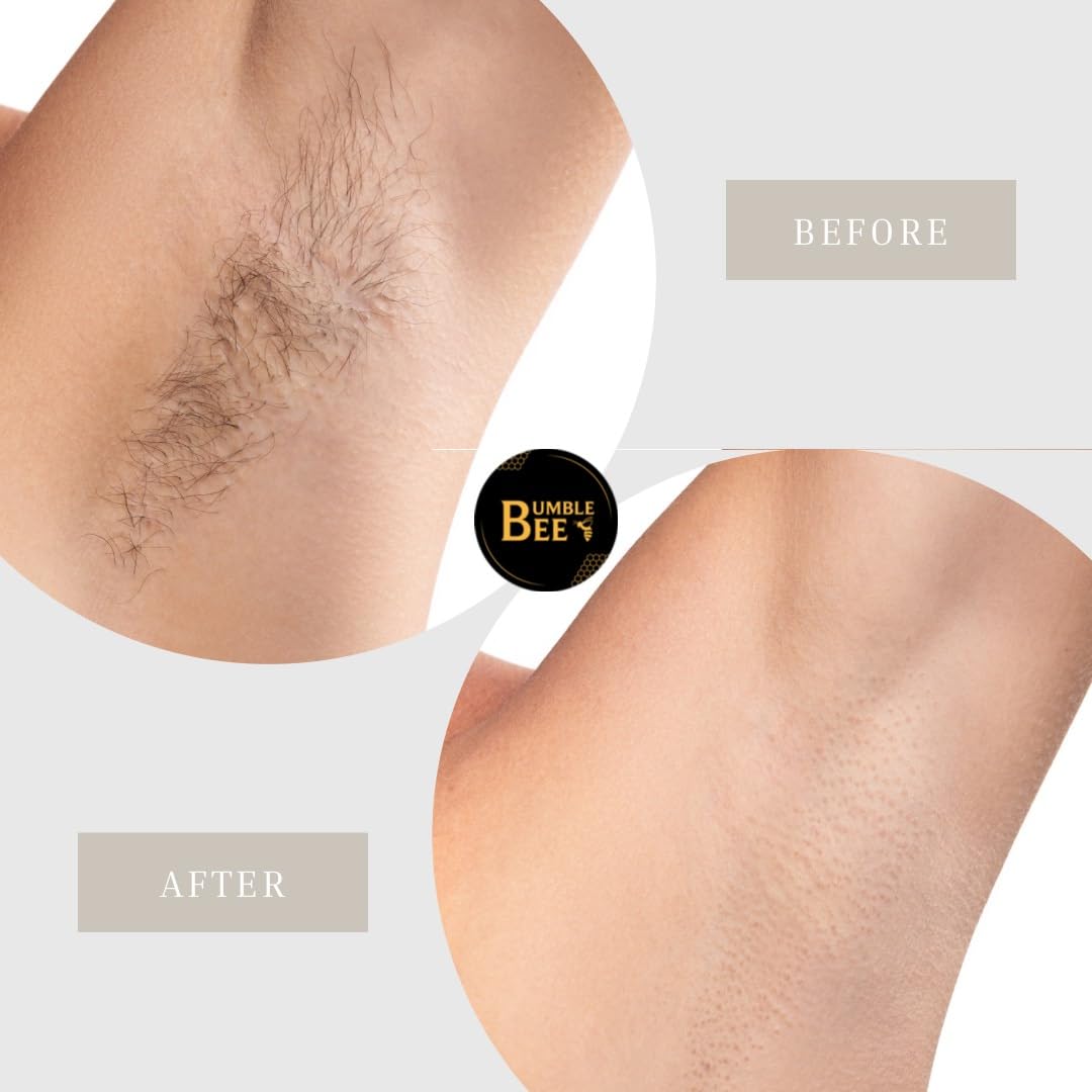 BUMBLE BEE Hair Removal Wax Kit for Women & Men - 500g Black Body Wax for Smooth Skin - Perfect for Legs, Arms, Bikini & Face Waxing at Home