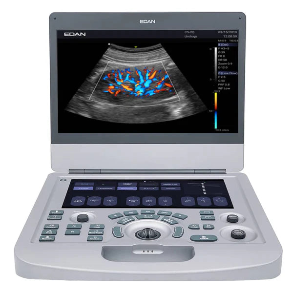 Edan Acclarix AX2 Portable Ultrasound System - Professional Handheld Diagnostic Device for Medical Clinics & Emergency Use
