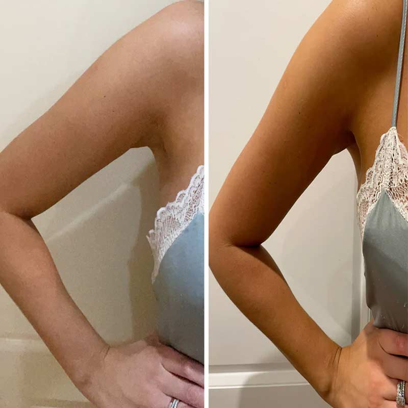 Beauti Edit Self Tanning Foam - Natural Looking Sunless Tan for Face & Body | Easy Application, Streak-Free Glow | Perfect for Beach, Vacation & Special Occasions
