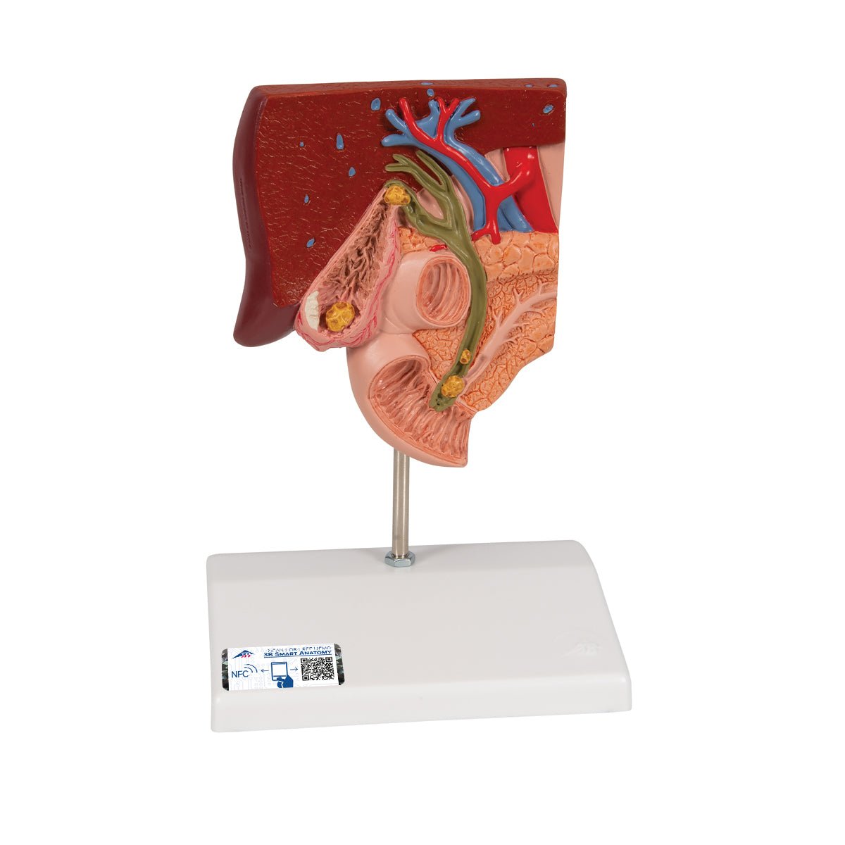 Gallstone Model with 3B Smart Anatomy K26 - Medical Teaching Tool for Human Digestive System Study & Classroom Demonstration