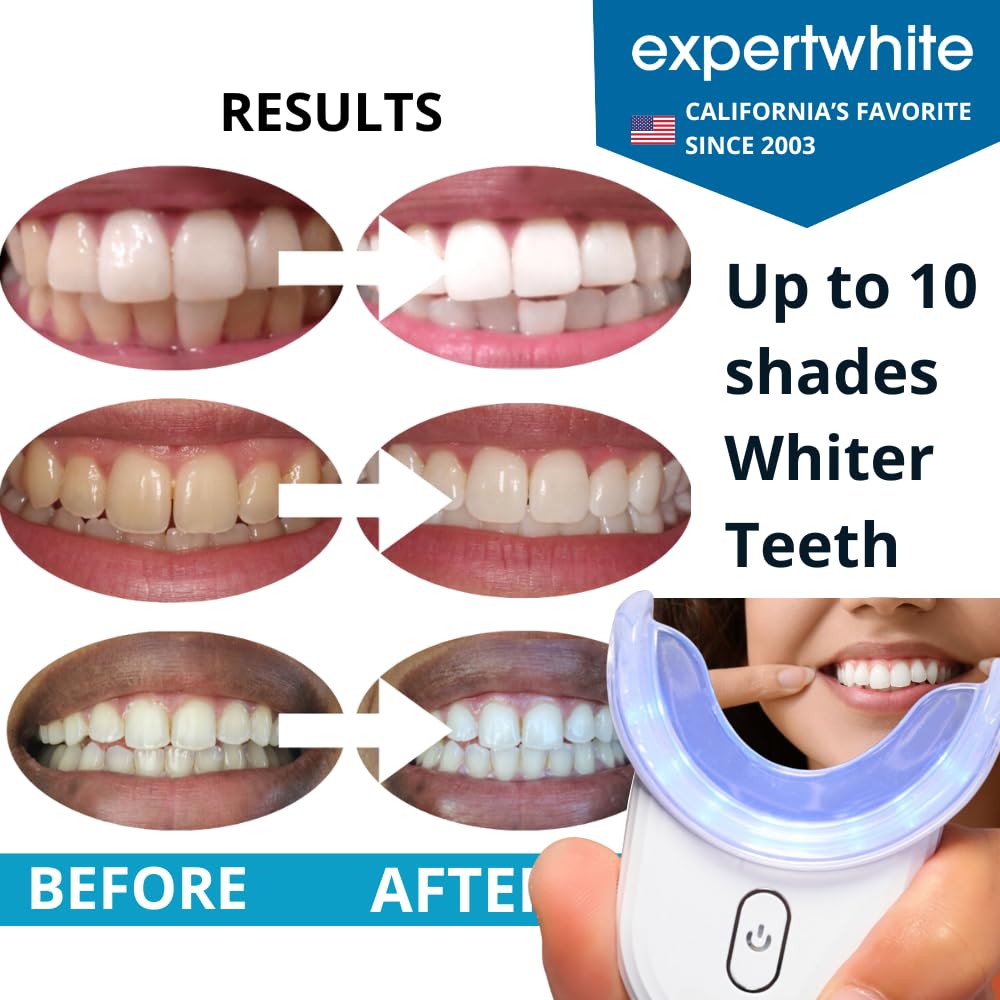 Professional Teeth Whitening Kit with 32x LED Accelerator Light - Dentist-Recommended Whitening Gel Pens for Sensitive Teeth | Enamel-Safe, Fast Results | Includes Mouth Tray & UV Light | Perfect for Home Use, Gifts, and Special Occasions