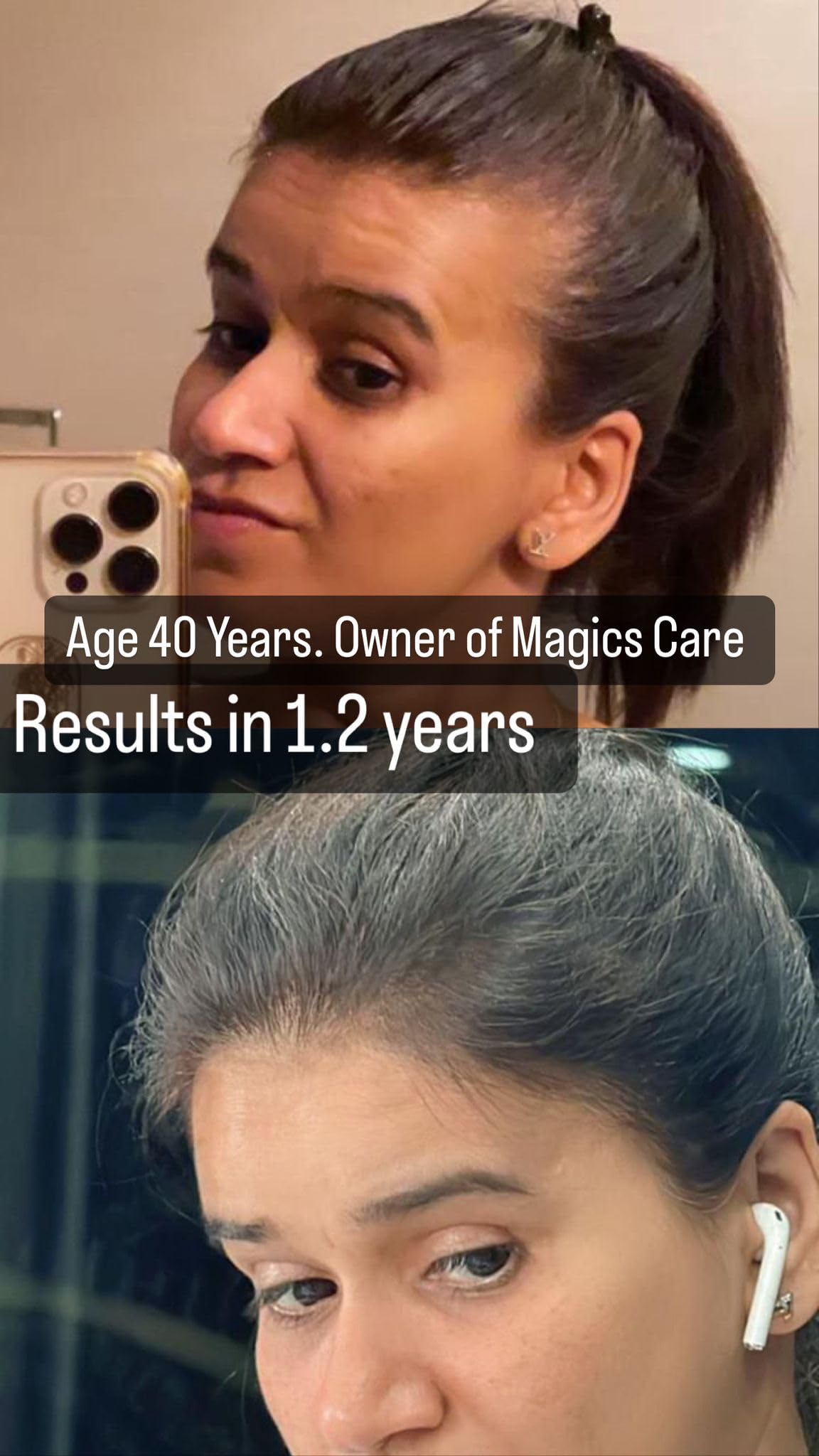 Magics Hair Care Powder & Ayurveda Shampoo Purifier Combo - All Natural, Chemical-Free Dandruff Treatment for Men, Women & Kids - Promotes Smooth, Shiny Hair - Easy to Use for All Ages - Perfect for Daily Hair Care & Scalp Health