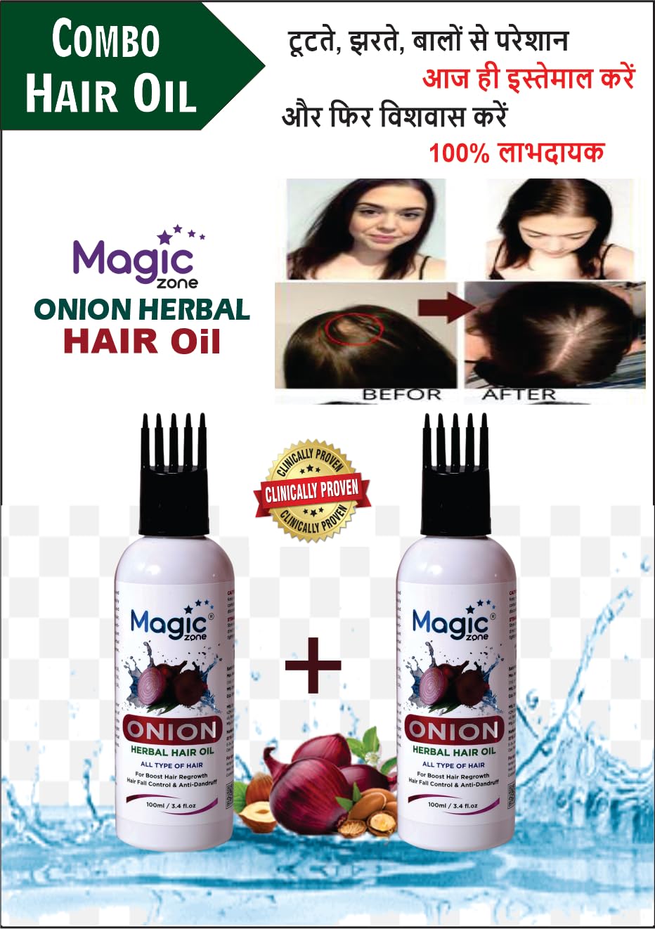 Magic Zone Onion Hair Oil for Hair Growth & Fall Control with Onion Extract & Redensyl - 2 Pack (100ml Each) | Promotes Thicker, Stronger Hair | Perfect for Daily Hair Care & Scalp Treatment