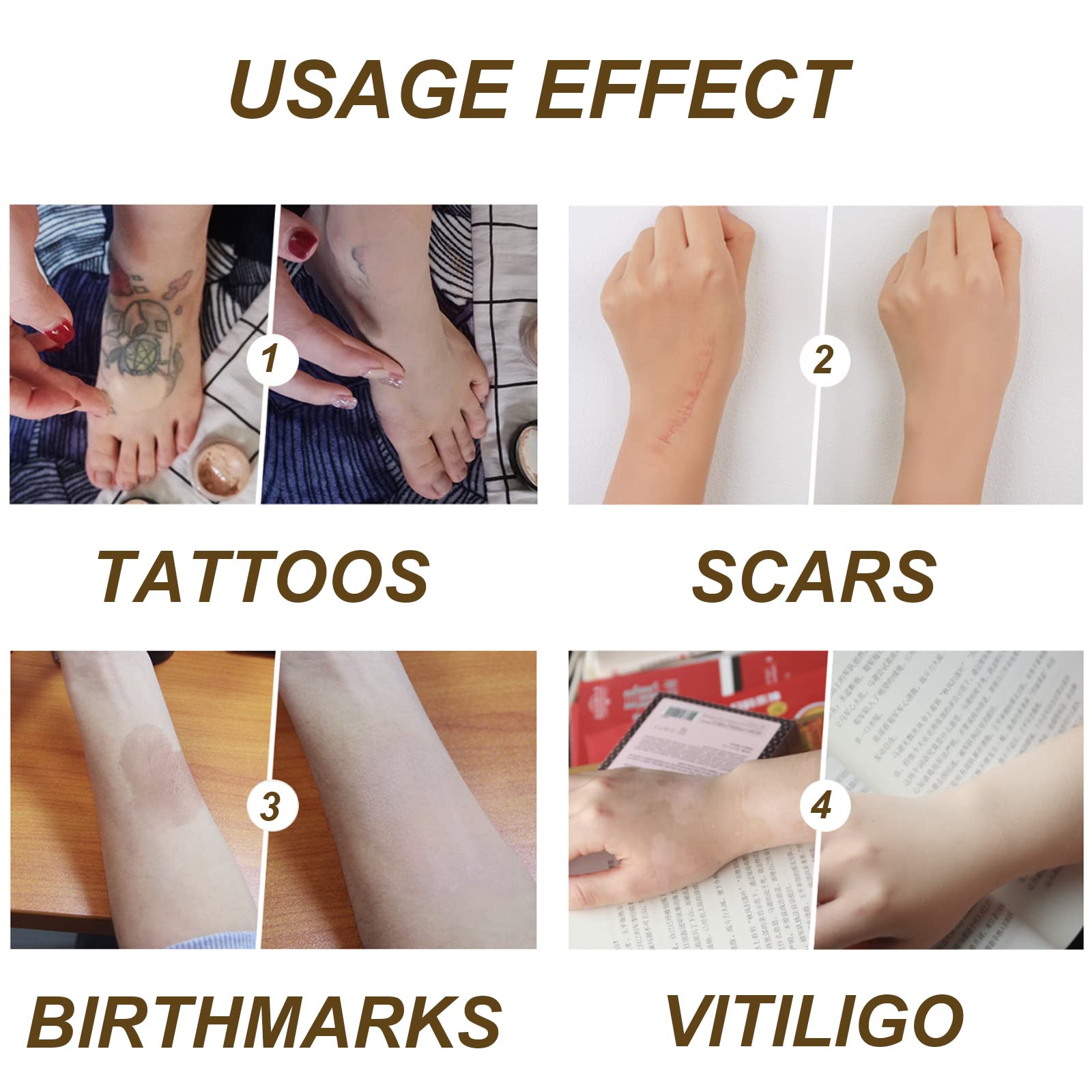 Waterproof Tattoo Concealer & Body Makeup - Full Coverage for Dark Spots, Scars, Birthmarks, Vitiligo & Varicose Veins | Long-Lasting Leg Makeup Foundation (Dark Color) | Perfect for Weddings, Beach Days & Professional Events