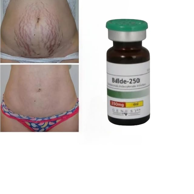 Best Stretch Mark Removal Cream for Men & Women - Pregnancy Safe, Scar & Wrinkle Treatment | Postpartum Care & Skin Repair