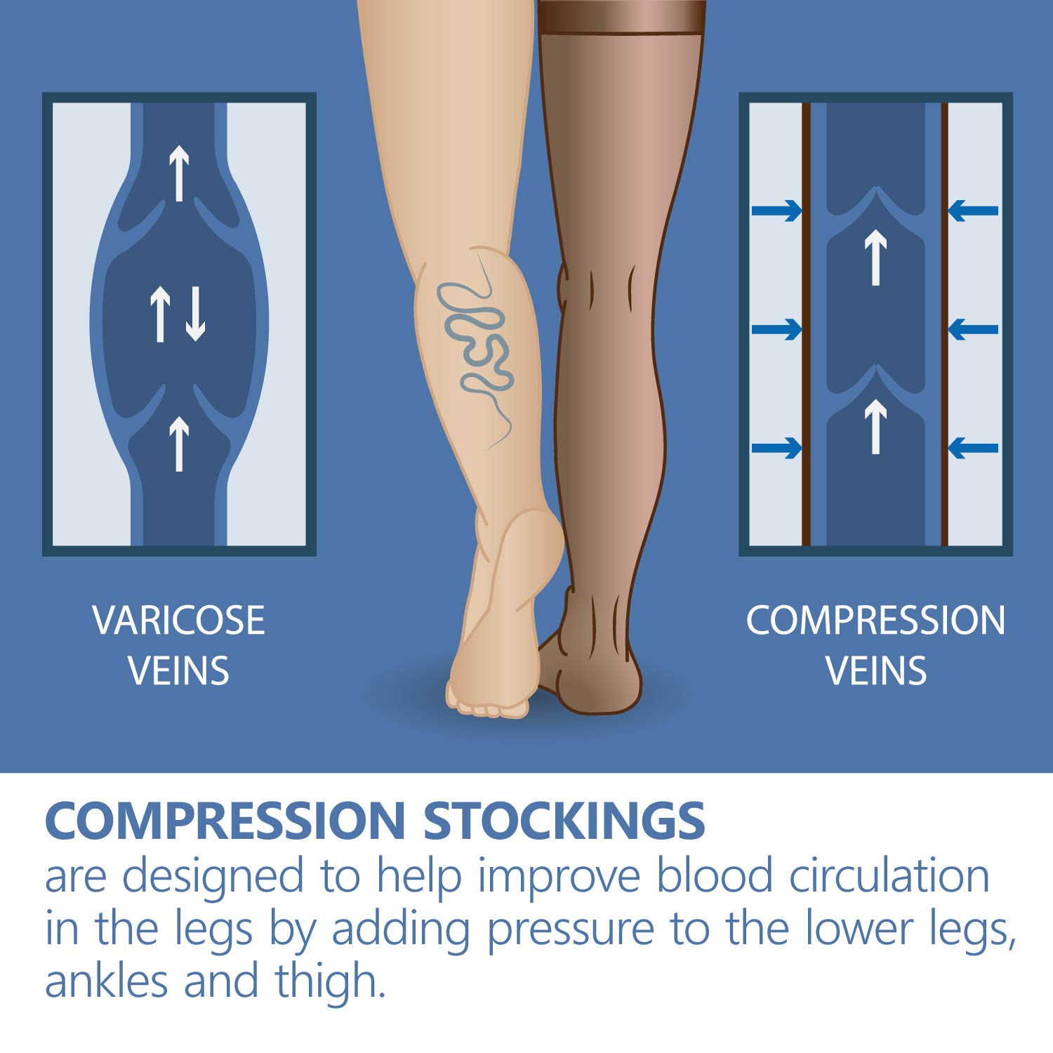 16-18 mmHg Medical Compression Tights for Better Circulation & Recovery - Black X-Large for Post-Surgery & Travel