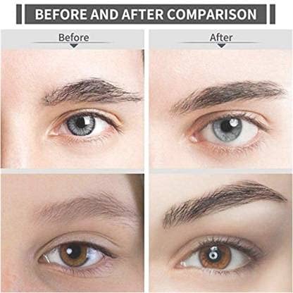 Mi 2 Portable Painless Electric Eyebrow Trimmer for Women - Battery Powered Facial Hair Remover, White (21.5 x 10.1 x 4.7 cm) - Perfect for Travel, Home & Salon Use