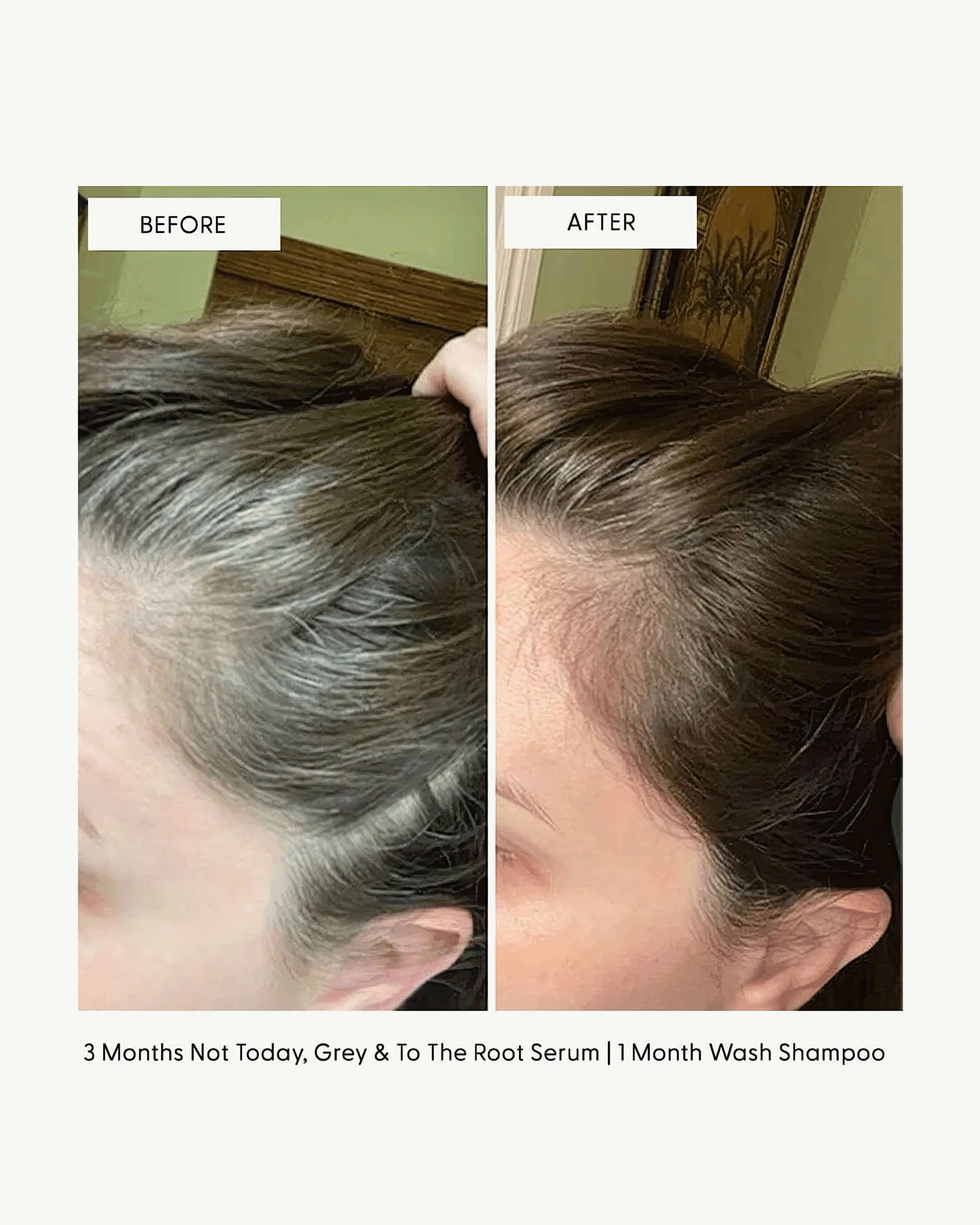 To The Root Hair Growth Serum - Natural & Organic Scalp Treatment for Thicker, Stronger Hair - Perfect for Daily Use at Home or Salon