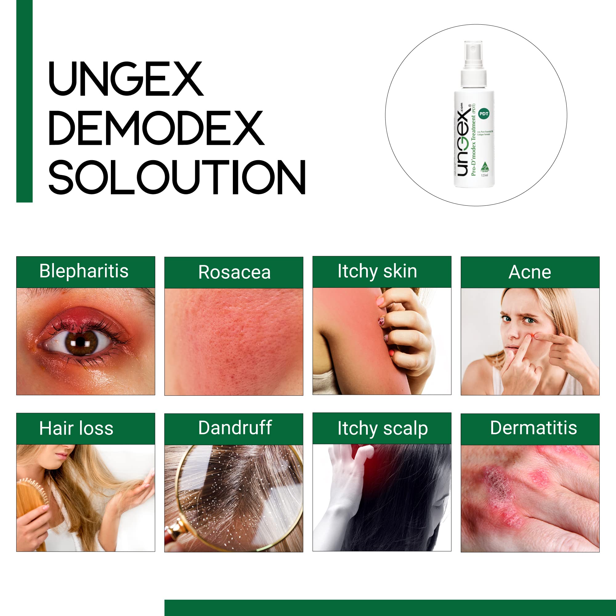 Ungex Pro-Demodex Treatment for Demodicosis | Professional Skin Care Solution for Face & Eyelids | Relieves Itching & Redness | Perfect for Sensitive Skin & Rosacea Sufferers | Use at Night for Best Results
