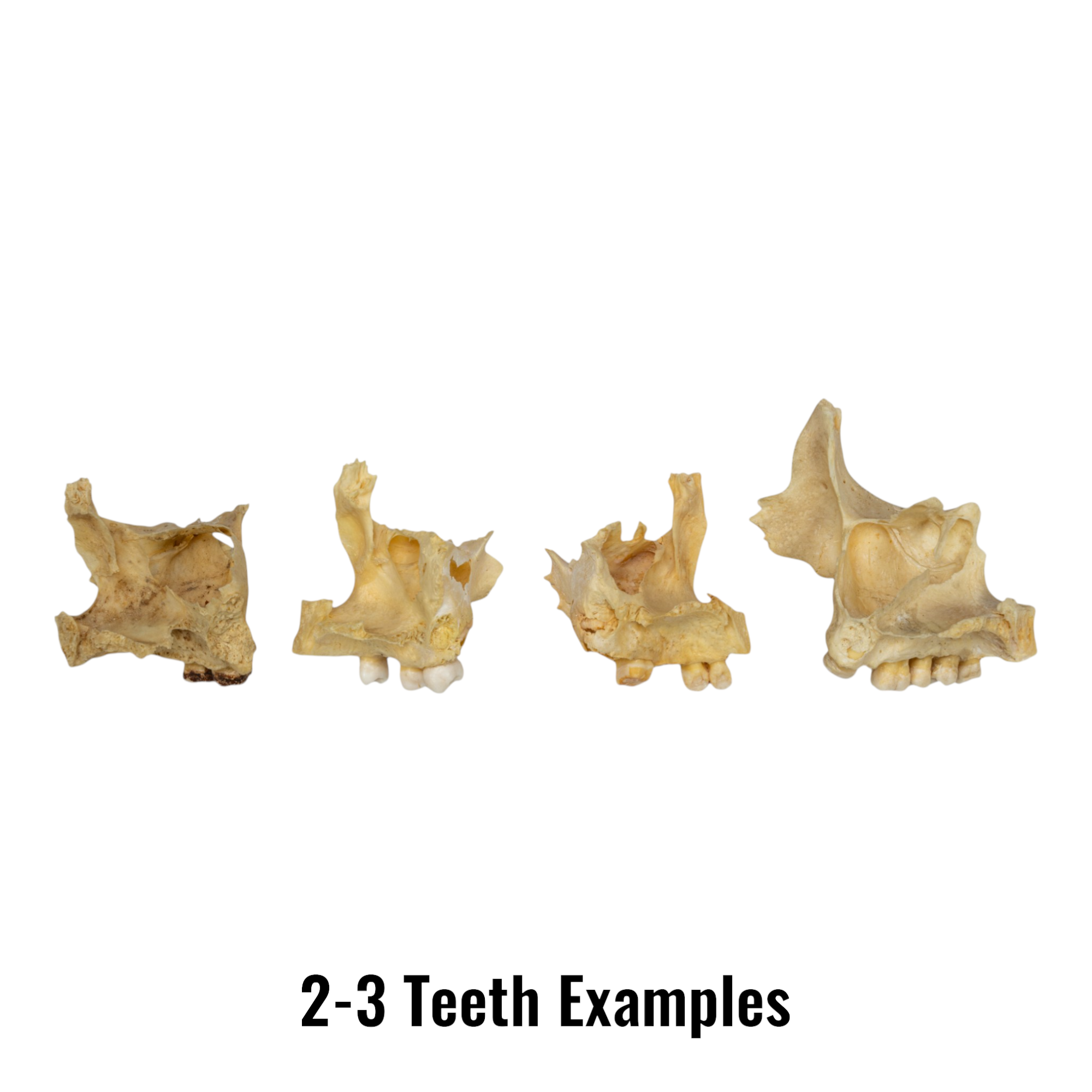 Authentic Human Maxillary Bone - Single Specimen for Medical Study, Dental Education, and Anatomy Research | Ideal for Students, Doctors, and Science Enthusiasts