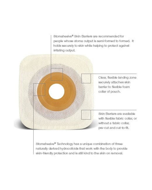 Convatec Esteem Synergy Convex Stomahesive Skin Barrier - 10 per Box, Cut to Fit up to 48mm (1 7/8
