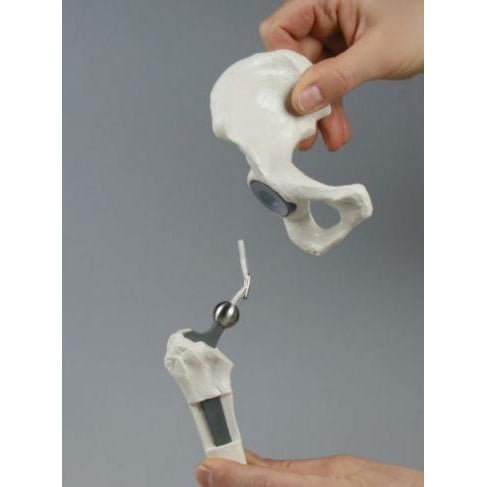 High-Quality Hip Implant Model - Medical Training & Surgical Demonstration Tool for Orthopedic Surgeons & Students