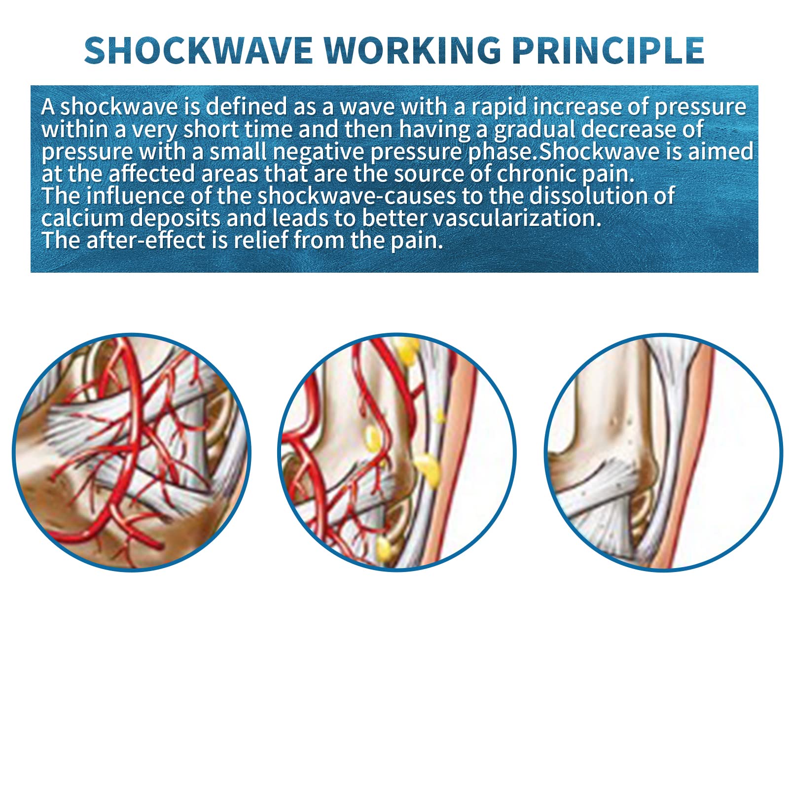 Shockwave Therapy Machine for Pain Relief - 7 Massage Heads for Deep Tissue Muscle Relaxation, Body Massager for Back, Neck, Shoulder & Leg Pain - Perfect for Home Use, Sports Recovery & Physical Therapy