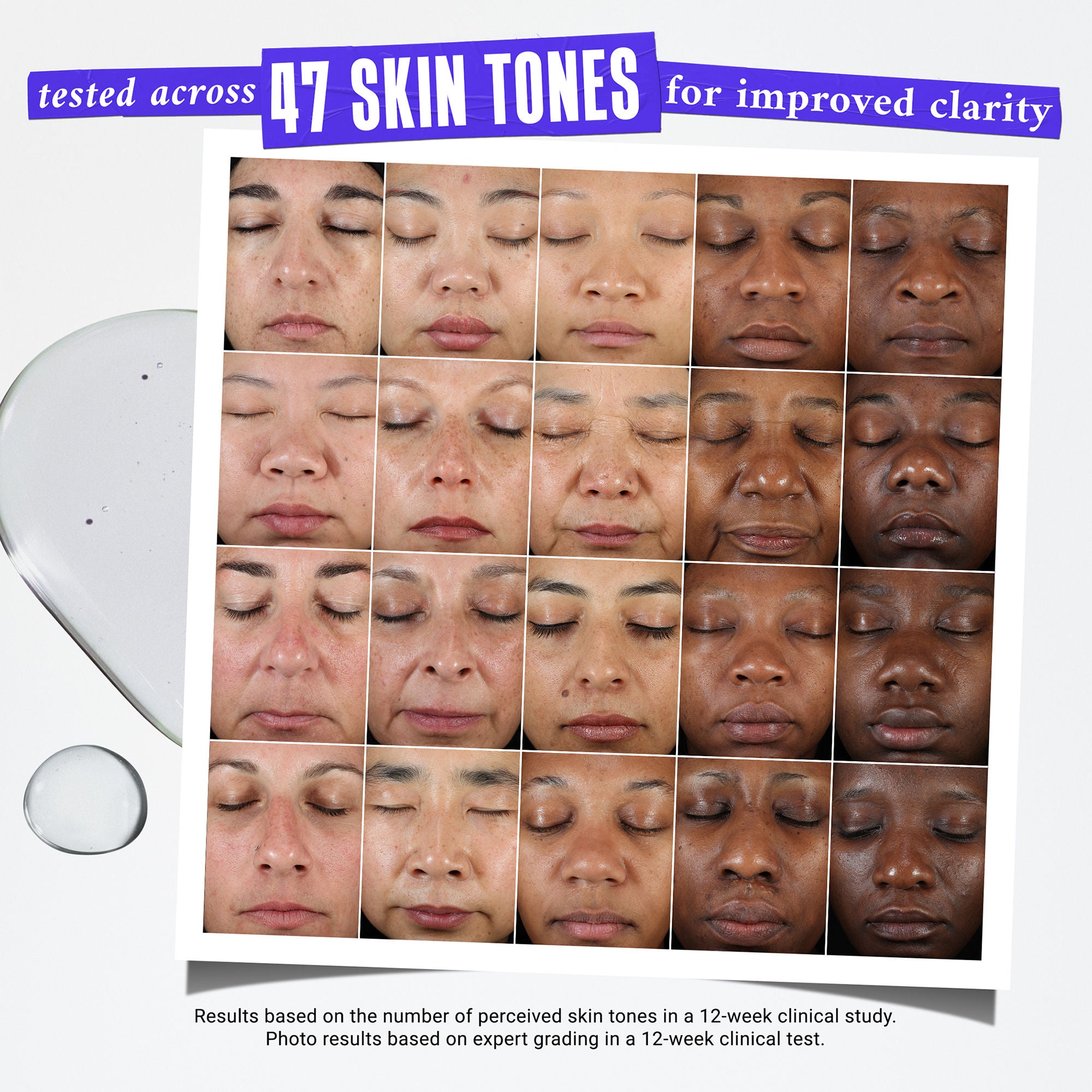 Kiehl's Clearly Corrective Dark Spot Solution - Brightening Serum for Hyperpigmentation & Uneven Skin Tone | Perfect for Daily Skincare Routine & Nighttime Use