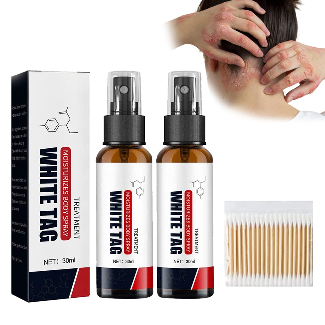 Dermax Psoriasis Treatment Spray for Scalp & Skin Relief – 30ml (2 Pack) – Fast-Acting Itch & Flake Solution for Dry, Irritated Skin – Perfect for Home, Travel & Daily Care