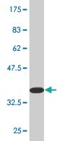 Anti-RGS5 Mouse Monoclonal Antibody [Clone 4000000000000] - 100µG for Research & Lab Experiments - Immune System Studies & Protein Analysis