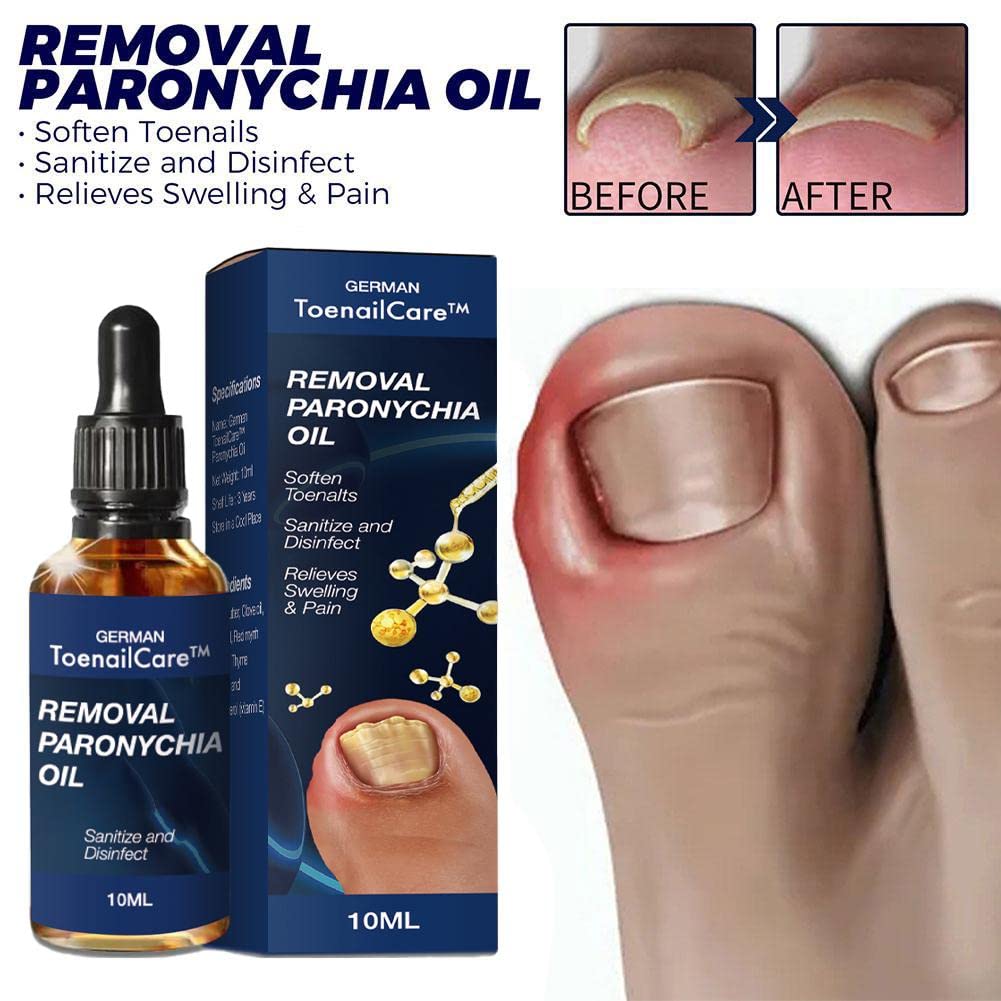 Toenail Care Removal Oil - Paronychia & Ingrown Toenail Treatment | Nail Renewal Liquid for Damaged & Discolored Nails | Fast Healing Solution for Healthy Feet | Perfect for Pedicures & Daily Foot Care