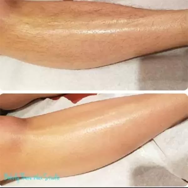 ASGTRADE Lemon 10-Minute Natural Herbal Instant Painless Wax Powder for Men & Women - Bikini, Brazilian & Full Body Hair Removal - 2-Pack Combo | At-Home Hair Removal Solution for Smooth Skin