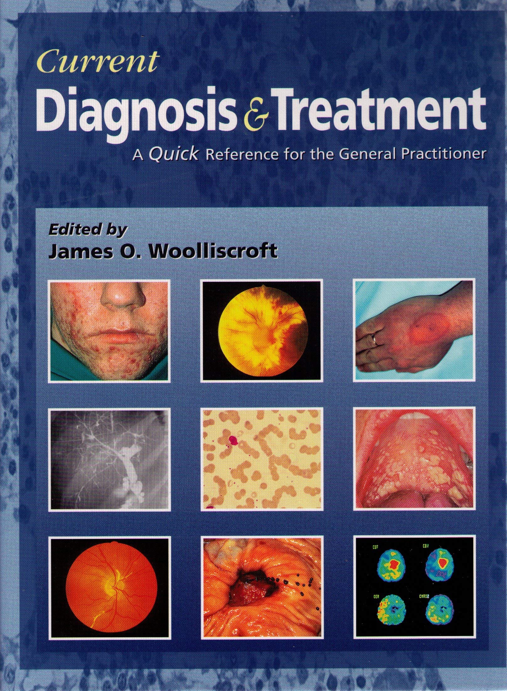Current Diagnosis & Treatment Guide: Quick Reference for General Practitioners - Essential Medical Handbook for Clinics & Hospitals