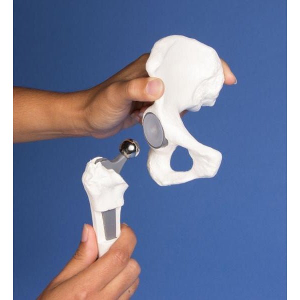 High-Quality Hip Implant Model - Medical Training & Surgical Demonstration Tool for Orthopedic Surgeons & Students