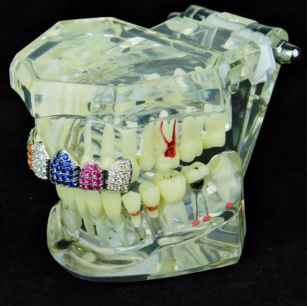 Multi-Color Grillz Silver Tone Top CZ Bling Clown Color Cubic Zirconia Rainbow Upper Teeth Hip Hop Grills - Perfect for Hip Hop Performances, Music Videos, and Streetwear Fashion