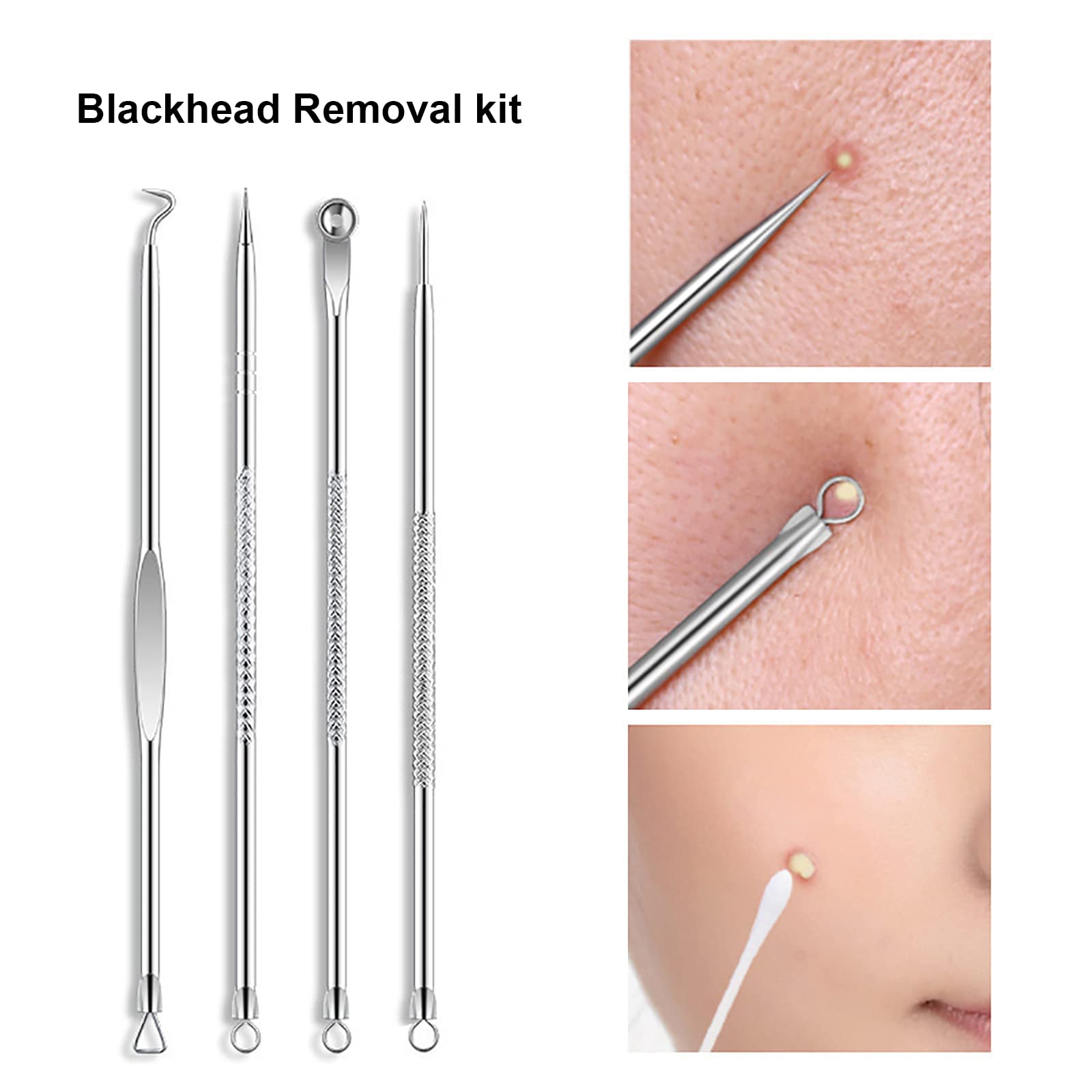 Professional 8-Piece Blackhead Remover Kit - Stainless Steel Pimple Popper & Comedone Extractor for Acne, Whitehead & Blemish Removal - Perfect for Facial Skincare & At-Home Spa Treatments