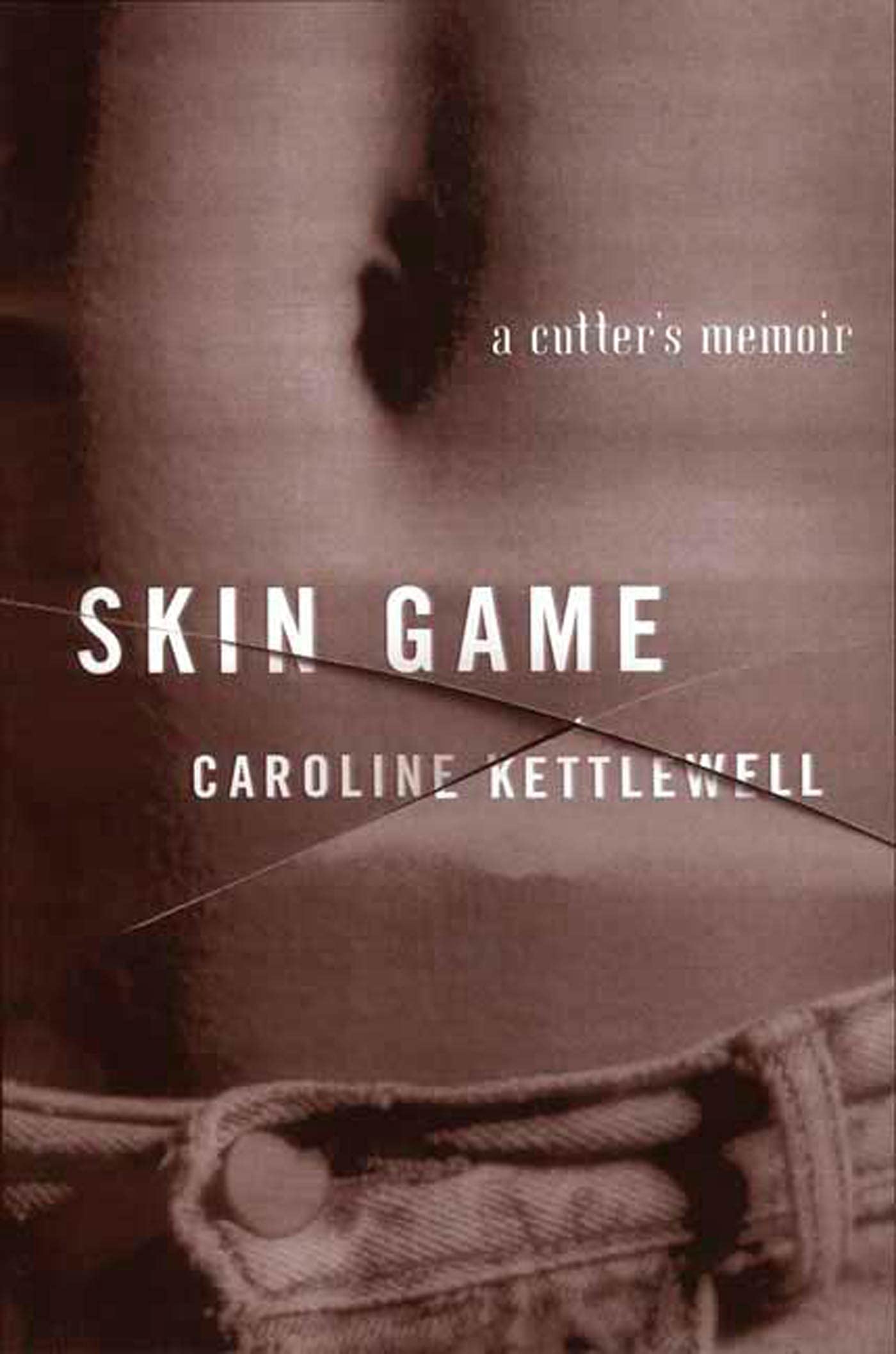 Skin Game: A Memoir - A Riveting True Story of Deception and Survival | Perfect for Book Clubs & Personal Growth Reading