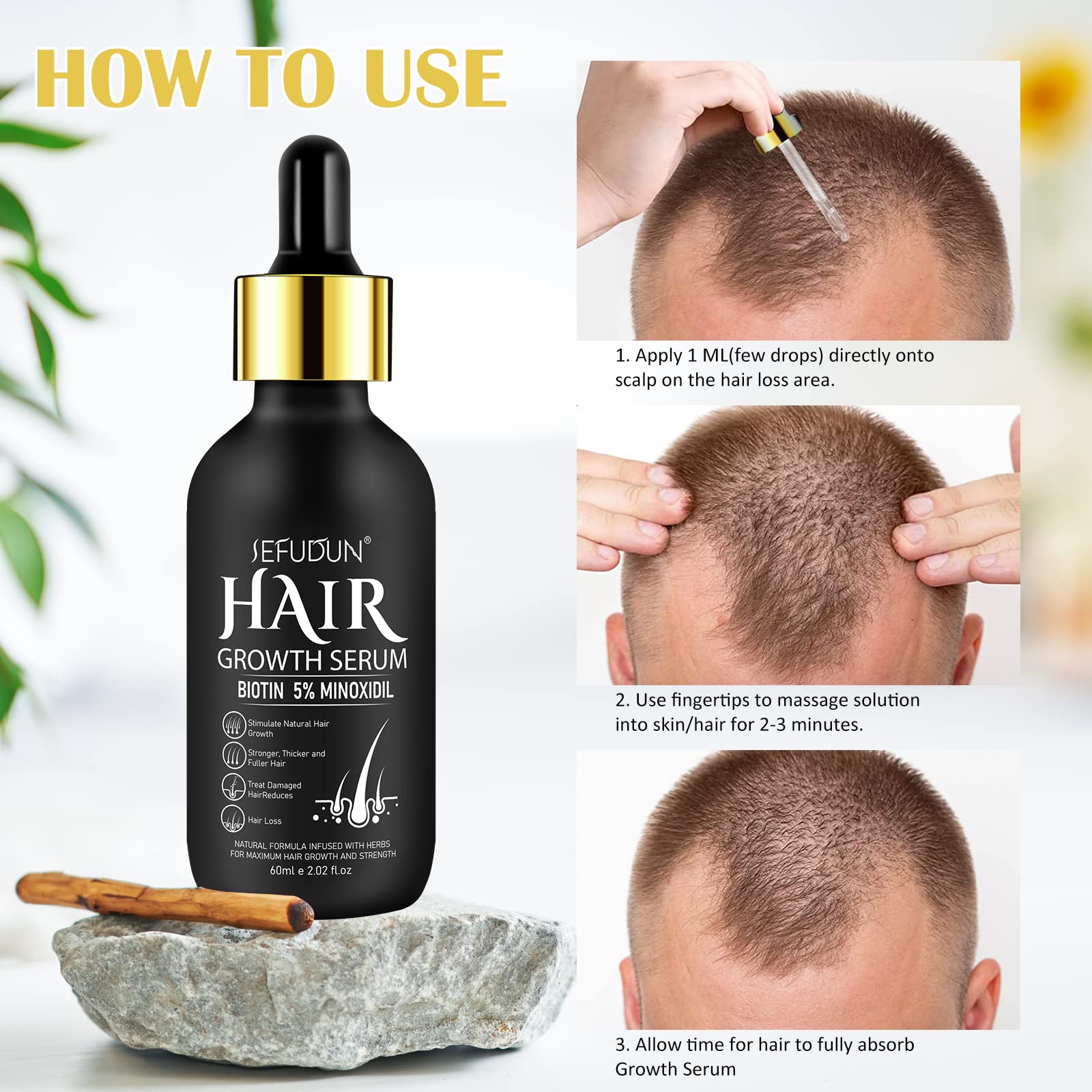 5% Minoxidil Hair Growth Oil for Men & Women - Biotin-Enriched Beard & Scalp Treatment for Hair Loss, Thinning & Healthier Hair (2.02 oz) | Promotes Fuller Beard & Revitalizes Thinning Hair for Daily Use