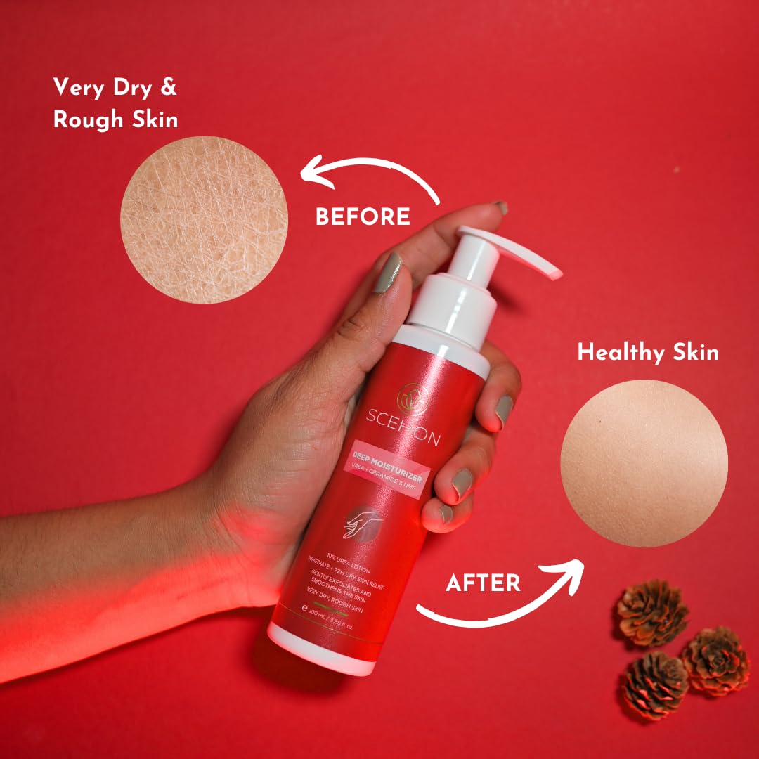 Scehon Deep Moisturizing Cream for Very Dry Skin - Hydrating Face Lotion with Gentle Exfoliation | 72-Hour Long-Lasting Dry Skin Relief | 3.38 fl oz | Perfect for Night Care & Winter Skin Repair