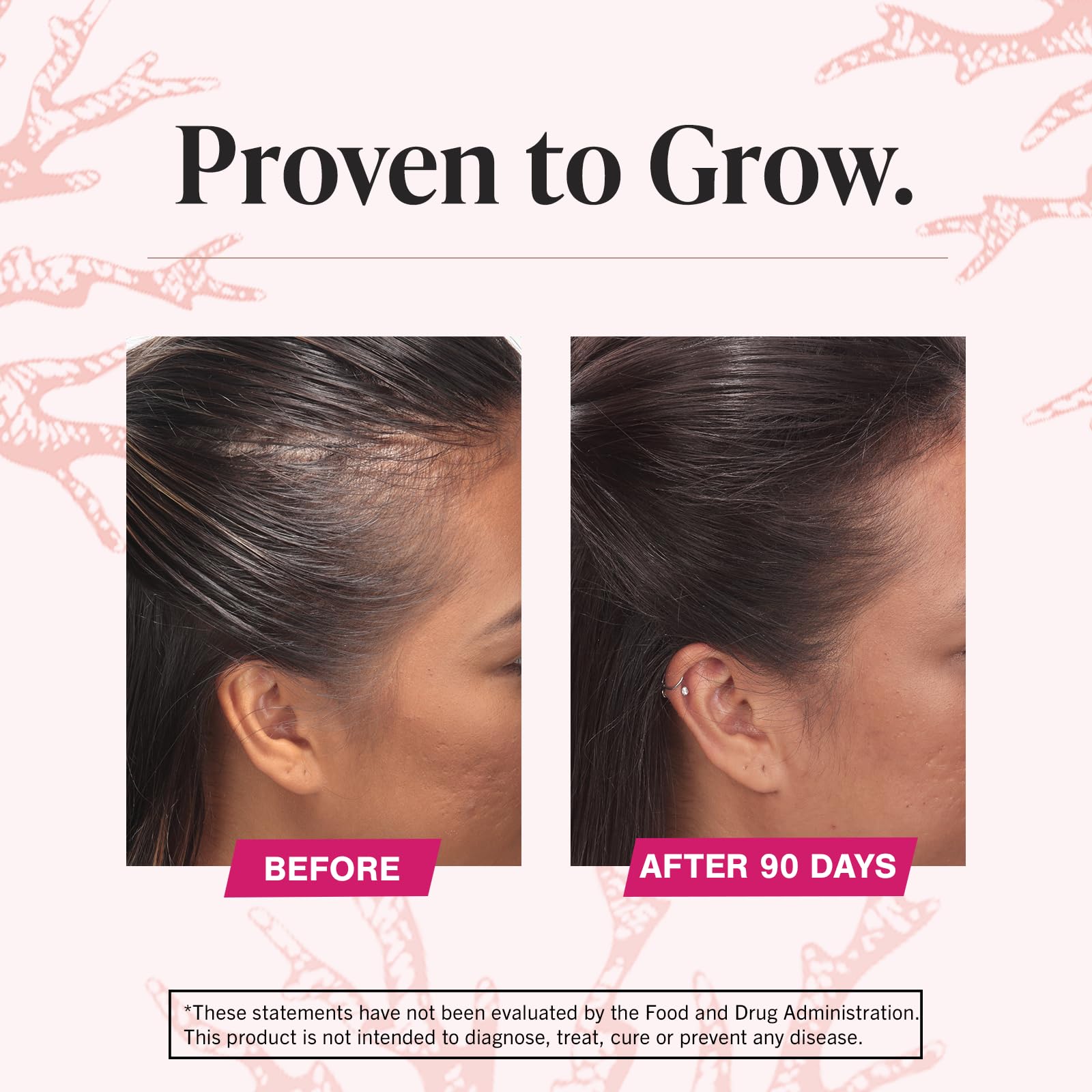 Viviscal Hair Growth Supplements for Women - Clinically Proven Hair Vitamins with Collagen Complex for Thicker, Fuller Hair | Reduces Hair Loss | 180 Tablets (3 Month Supply) | Perfect for Postpartum, Menopause & Styling Damage Recovery