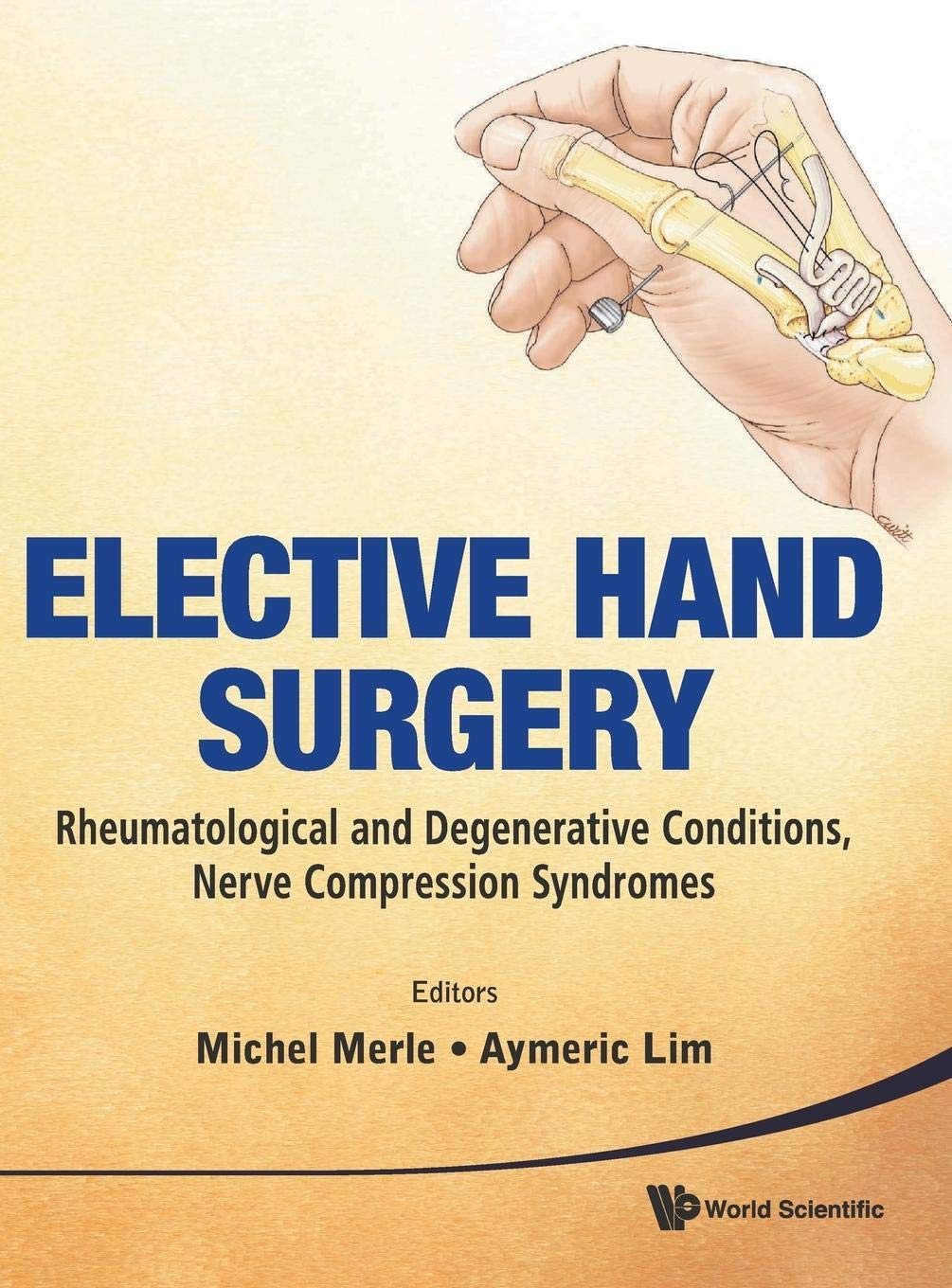 Elective Hand Surgery Guide: Treating Rheumatological & Degenerative Conditions, Nerve Compression Syndromes - For Arthritis & Carpal Tunnel Relief