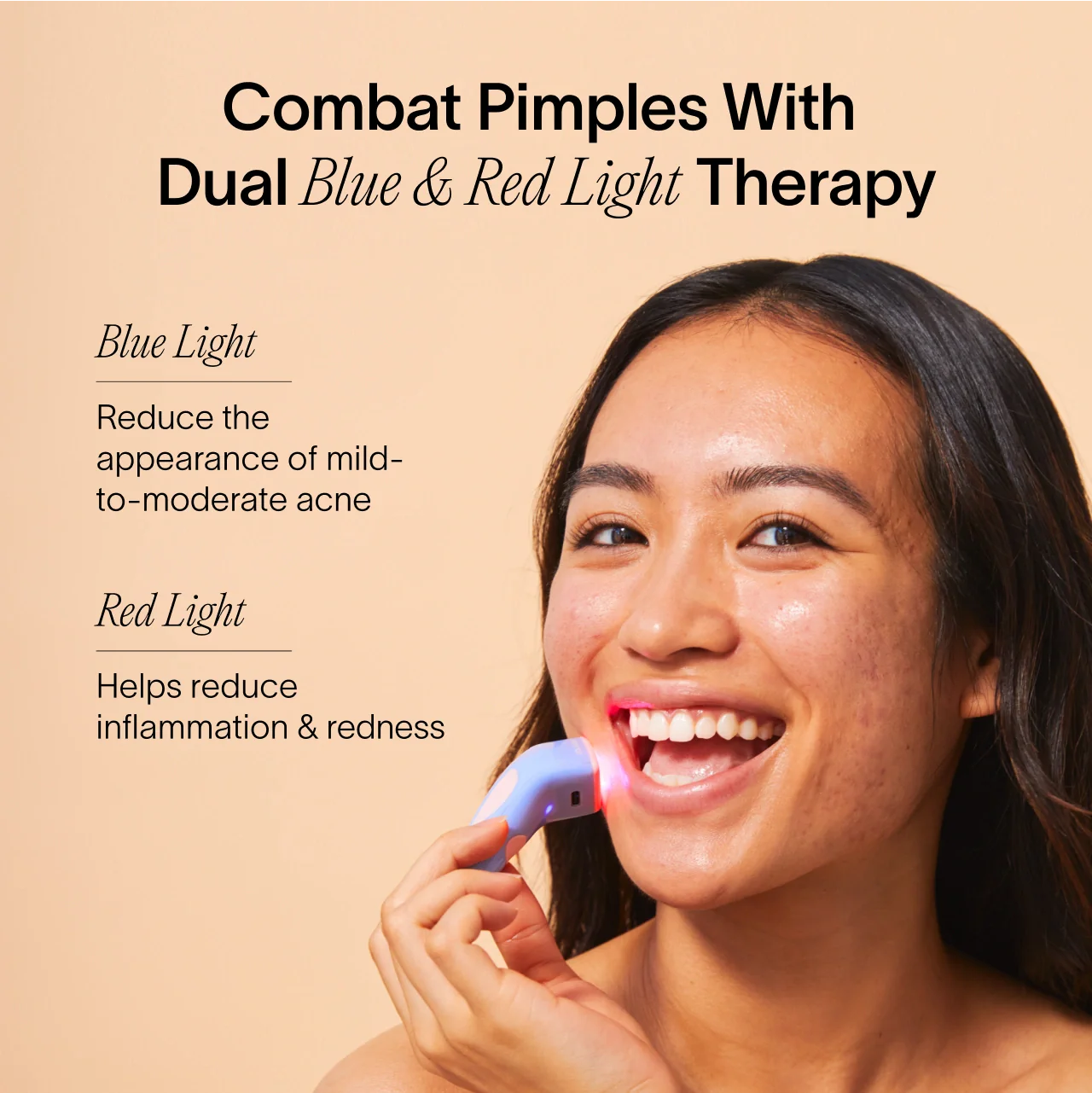 Bye Acne: Fast-Acting 3 Minute Pimple Spot Treatment for Clear Skin | Perfect for Overnight Use & On-The-Go Acne Care
