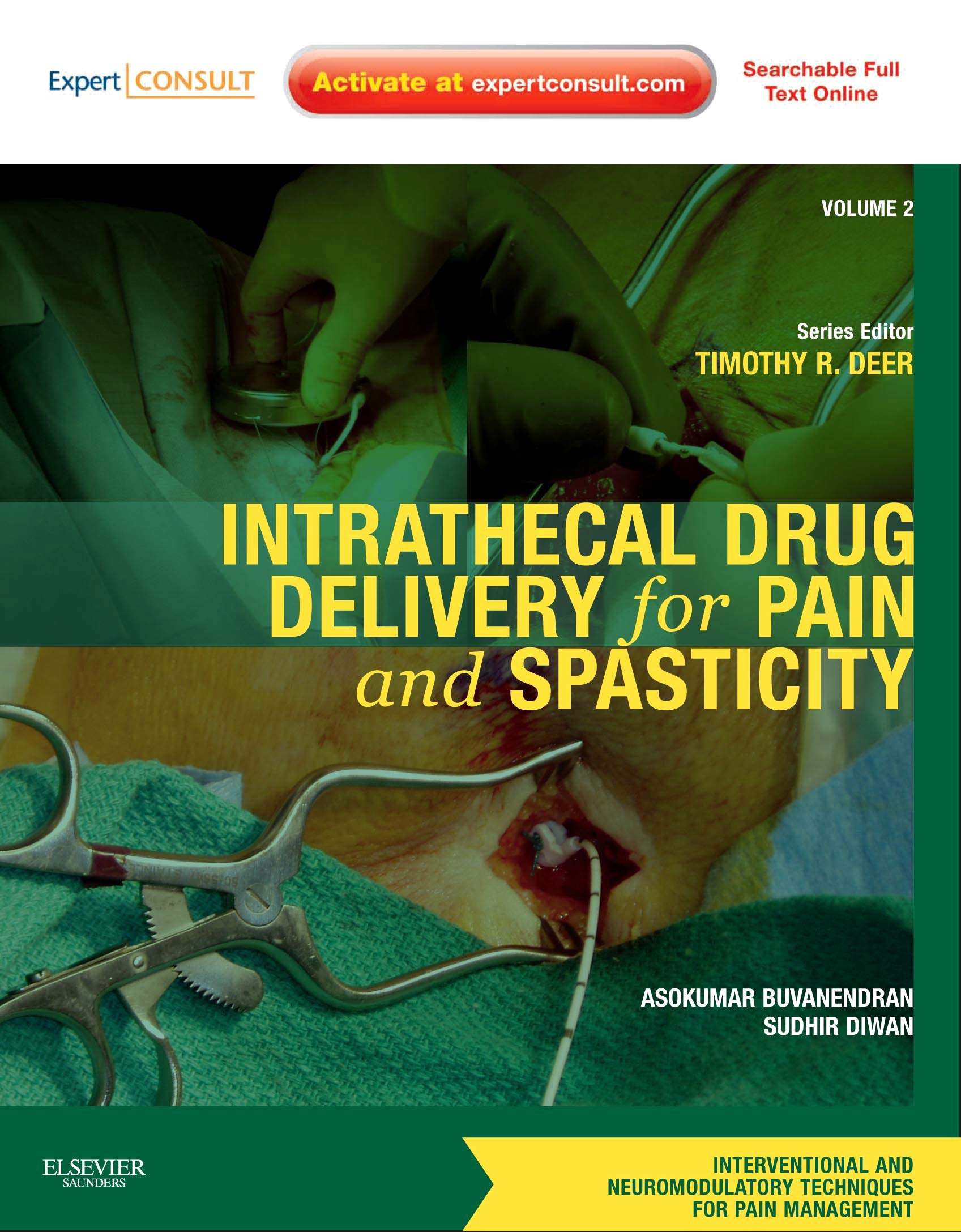 Intrathecal Drug Delivery System for Pain and Spasticity Management - Volume 2 | Interventional & Neuromodulatory Pain Relief Techniques | Clinical Use for Chronic Pain Patients
