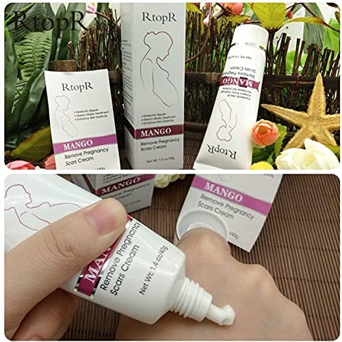 RtopR Mango Stretch Marks & Scar Removal Cream for Pregnancy - Best Body Moisturizer for Smooth Skin - 80g - Perfect for Postpartum Care & Skin Repair