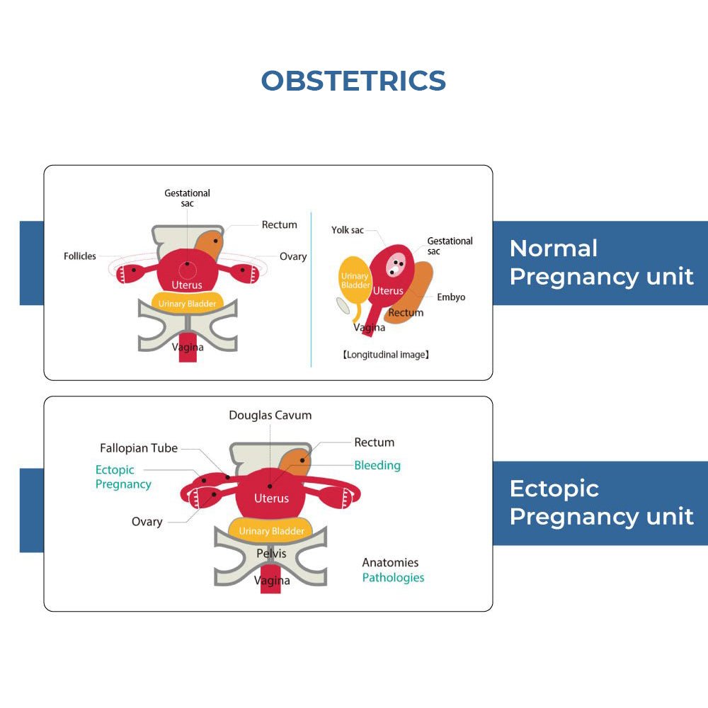 Female Pelvic Ultrasound Phantom for Transvaginal & Transabdominal Training - Obstetrics & Gynecology Practice Model for Medical Simulation & Education