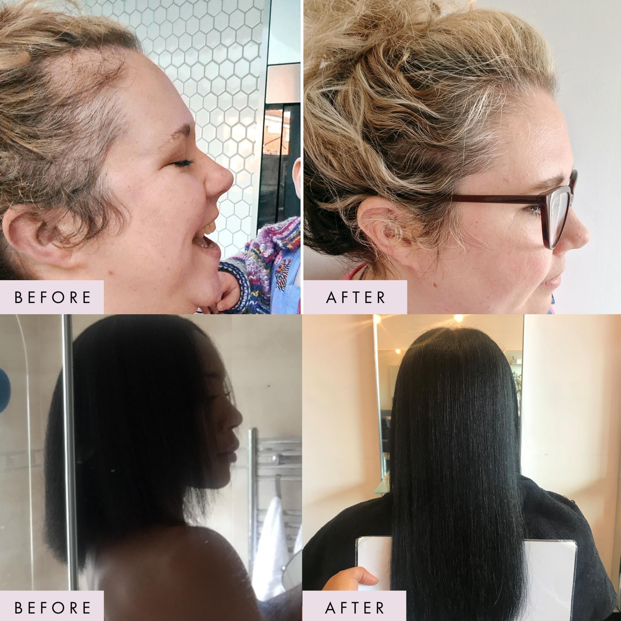 Premium Biotin Hair Growth Supplement with Enhanced Vitamin Complex | Supports Fuller, Thicker Hair, Healthy Skin & Strong Nails | Vegan Capsules for Women | 3 Month Supply | Perfect for Daily Hair Care Routine & Postpartum Recovery