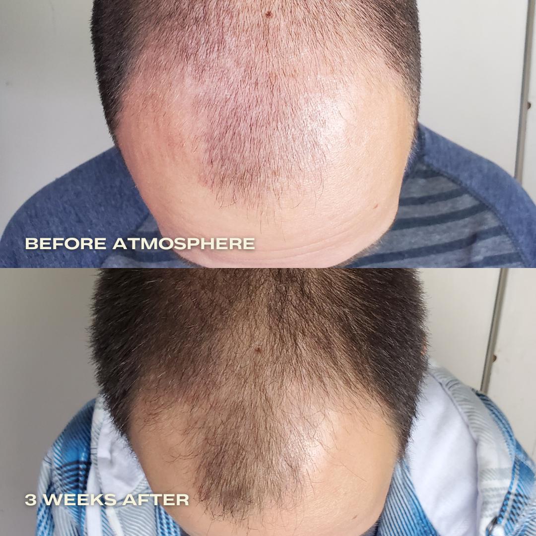 Atmosphere Hair Density & Scalp Serum for Thicker Hair Growth - Natural Hair Loss Treatment & Scalp Care Solution for Men & Women - Perfect for Daily Use & Hair Regrowth Routine