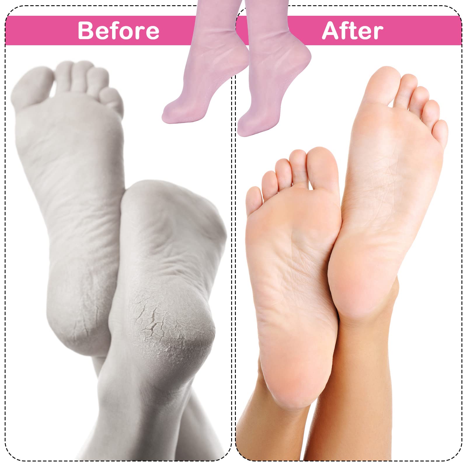 2pcs Moisturizing Gel Socks for Women - Soft Silicone Foot Care for Dry Skin & Cracked Heels - Home Spa & Night Treatment
