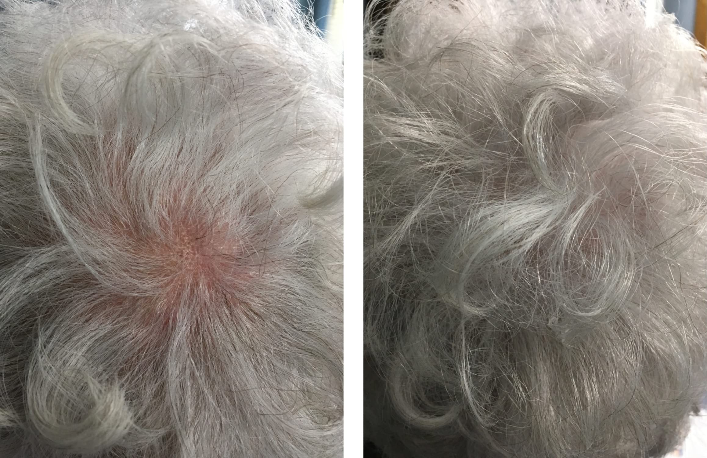 Caboki Hair Building Fiber for Thinning Hair - Travel Size (8-14 Days Supply) Silver/White | Natural-Looking Hair Concealer for Men & Women | Perfect for Daily Use, Travel, and Special Occasions