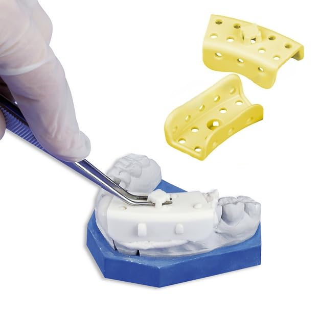 25-Pack Dental Mini Impression Trays for Crown & Bridge - Micro-Tray Quadrant Impressions (Yellow) - Perfect for Dentists, Orthodontists & Dental Labs