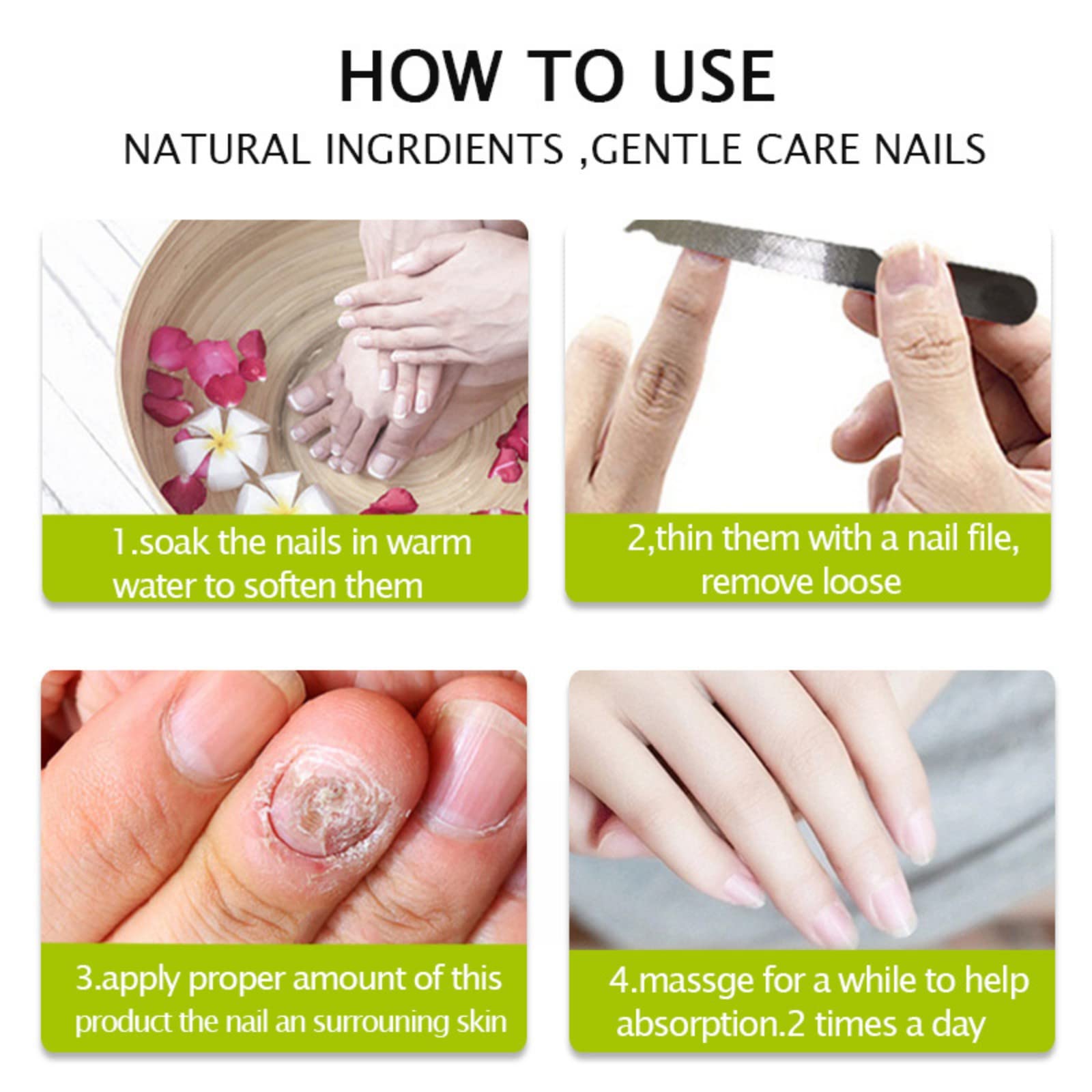 2PCS Nail Repair Gel for Fungal & Damaged Nails - Toenail Treatment & Care - Fast Results in 7 Days - Strengthens & Restores Nails - Perfect for Pedicures, Manicures & At-Home Nail Care