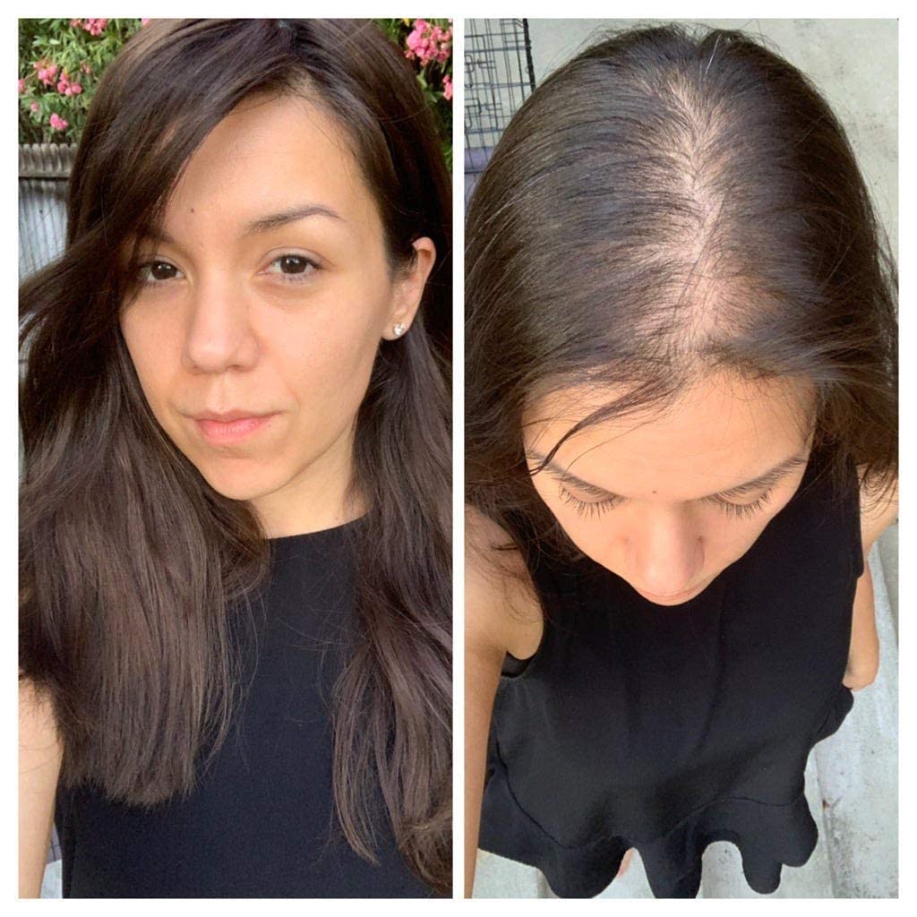 Gramercy Hair Silk Base Human Hair Clip-In Toppers for Women - Straight & Thin Hair Crown Extensions for Hair Loss | Perfect for Daily Wear, Styling & Volume Boost
