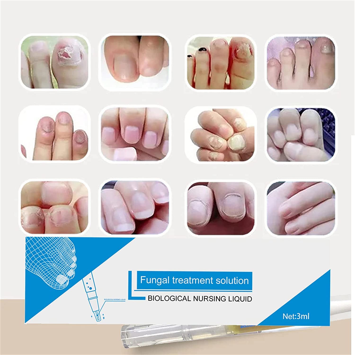 Okita Toenail Fungus Treatment Pen - Fast-Acting Antifungal Nail Repair for Toenails & Fingernails - Clinically Proven Fungus Eliminator (3 Pack) - Perfect for Athletes, Swimmers & Daily Foot Care